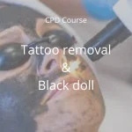 CPD Training in tattoo removal, permanent make-up removal, carbon peel - Q-switched Nd:Yag laser